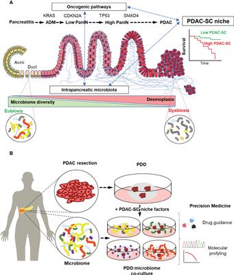 Challenges in precision medicine in pancreatic cancer: A focus in cancer stem cells and microbiota